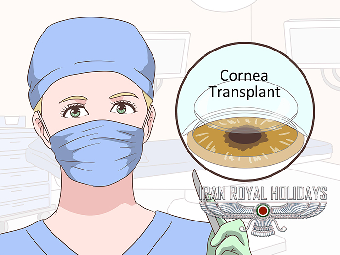 Corneal transplantation in iran